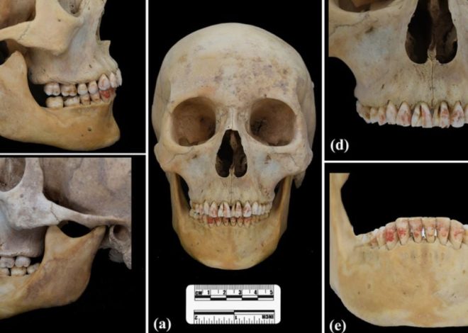 2200 -year -old Chinese burial unveils women with poisonous red stained teeth